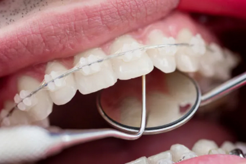 截圖14444.jpg 截圖14444.jpg