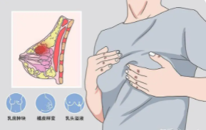 隆胸2 (2).png 隆胸2 (2).png