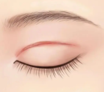 雙眼皮8.png 雙眼皮8.png