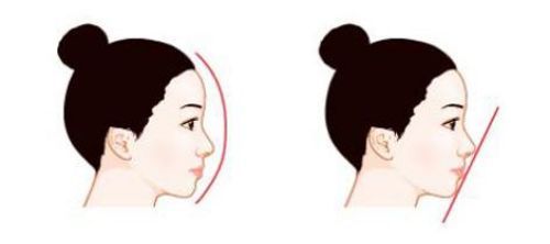 src=http%3A%2F%2Fwww.100xing.com%2Fuploadfile%2Fimage%2F20151104%2F1446627696102101.png&refer=ht