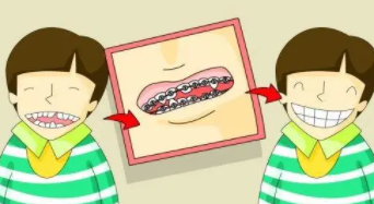 牙齒矯正21.png 牙齒矯正21.png